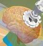 بازی آنلاین عمل جراحی مغز